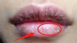 肝不舒服，身體有3種表現，常喝1種水，吸走肝臟毒素，肝臟更健康