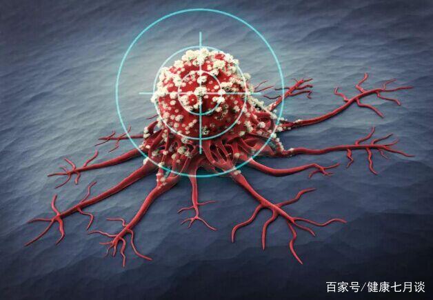 「江姐」40年前患癌，術後堅持做4事，不吃1種食物，98歲依然健康