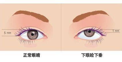 眼睛「乾乾」的，別以為是小事....大病來臨前，身體給你14個預兆！！再不注意來不及了