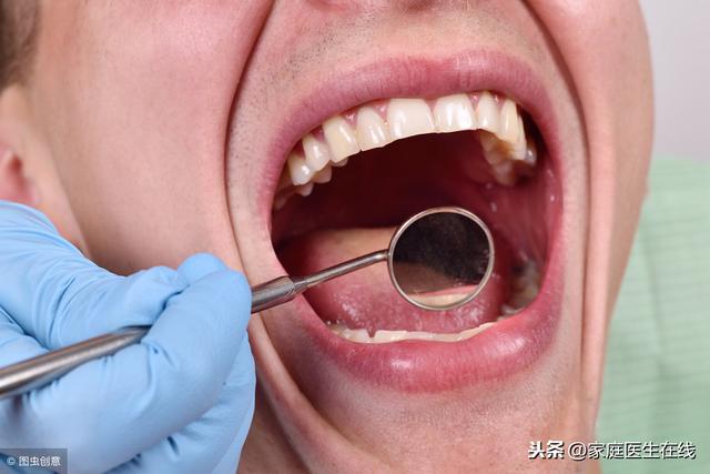 牙齒那麼多顆，缺一個沒關係？醫生細數缺牙隱患！