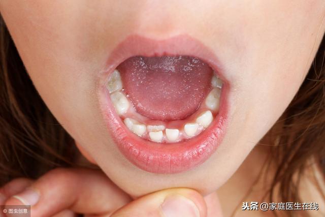 牙齒那麼多顆，缺一個沒關係？醫生細數缺牙隱患！