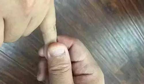 每天按摩小拇指50次，堅持一段時間，腰不疼、腿不酸，連頭髮也烏黑了，不用去染髮