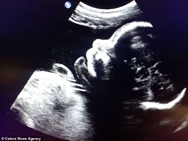曾是女兒身！他變性成男人「某天卻意外懷孕」　挺大肚上街「被路人罵怪物」9個月後奇蹟：再痛都值得 