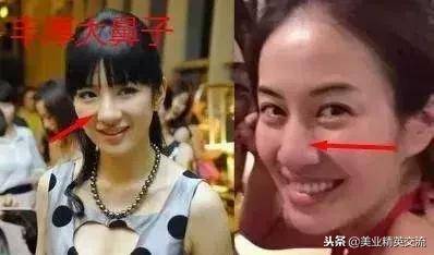 鼻子上有這根線的女子，好老婆面相，一般人娶不到