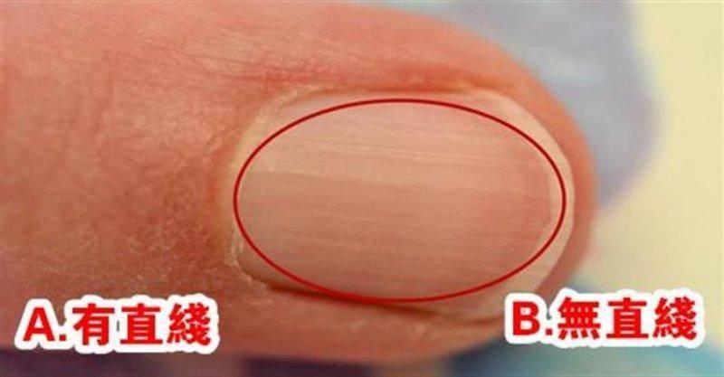 你的指甲上有一道道直線嗎？性格命運大不同，據說很準