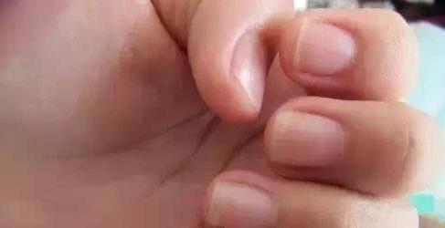 你的指甲上有一道道直線嗎？性格命運大不同，據說很準