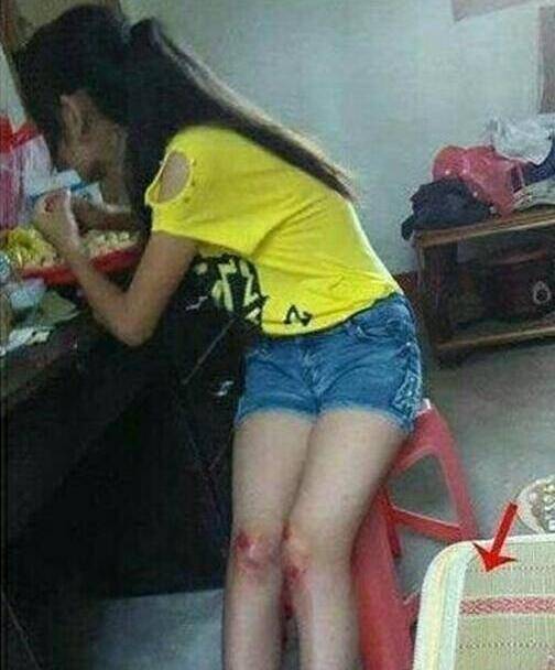 超搞笑的25張內涵圖，據說男生才看得懂。姑娘騎車這麼不小心，把膝蓋都摔破了...