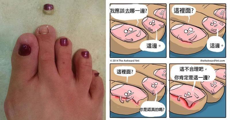 17個會讓人覺得超噁爛的「腳指甲知識」　人類的腳指甲其實是爪子