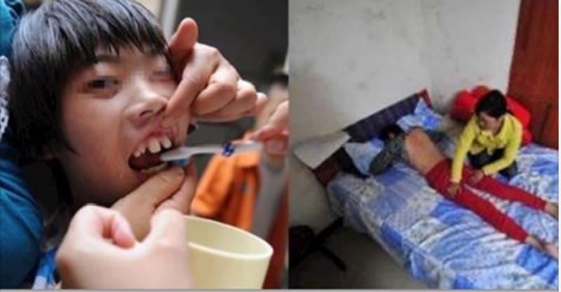  媽媽給智障女兒買了孤兒丈夫，兩人誤打誤撞懷上寶寶， 生孩子時丈夫讓眾人都嚇傻了！！