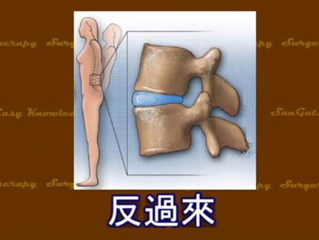 腰痛要自己救，復健師分享「私房 2 招」，改善腰酸疼痛，促進血液循環，腰椎越來越好！