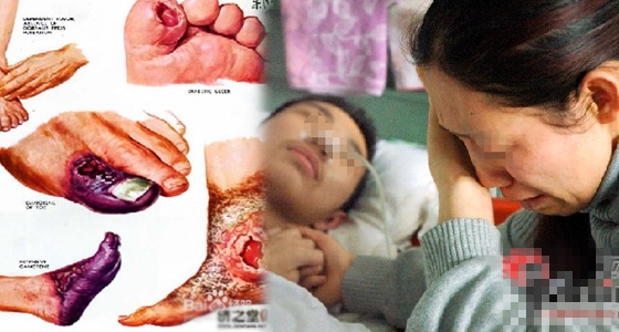 糖尿病有救了!預防糖尿病最有效方法竟然是它?!一定要分享出去! 