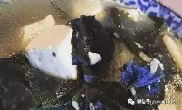 再不注意這6個信號！你的血管就要堵了！ 