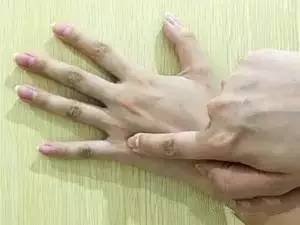 人體自帶消炎、解氣、排毒閥，不花錢不求人，不看太虧了 