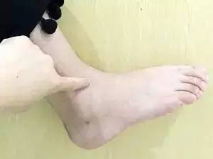 人體自帶消炎、解氣、排毒閥，不花錢不求人，不看太虧了 
