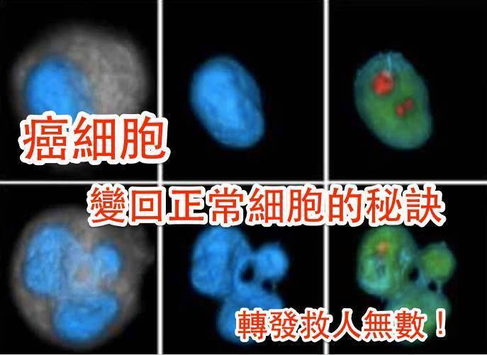 讓癌細胞「變回」正常細胞的秘訣！讓你 1 年內治好癌症！
