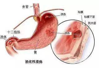生什麼病，忌什麼口，留著這張表，不用問醫生！