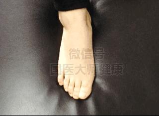 低頭摸腳，讓你一身輕鬆！很多病在腳上都有開關！