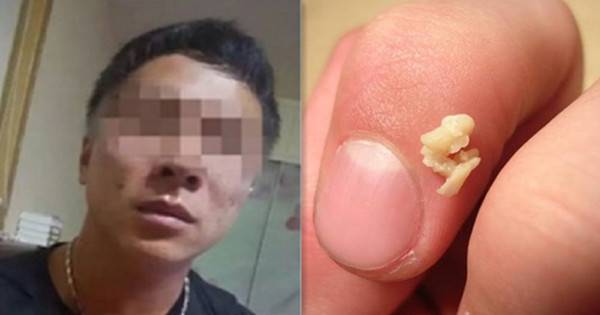 我從小就有口臭的困擾，都聞到「怪怪的味道」，去看醫生後……真相大白了！