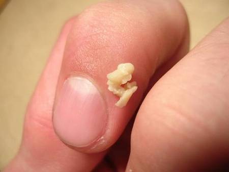 我從小就有口臭的困擾，都聞到「怪怪的味道」，去看醫生後……真相大白了！