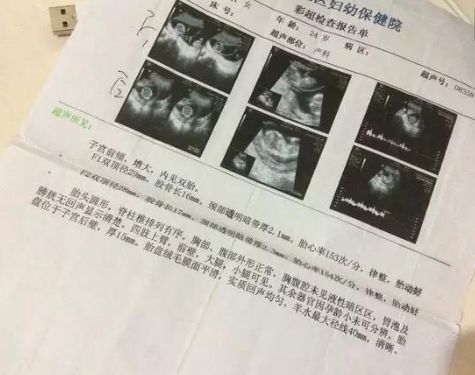 家婆五十多歲懷孕了，老公堅持讓婆婆生，瞥見產檢單，俺如遭雷擊