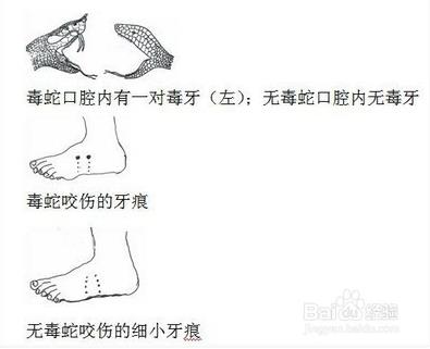 真人真事！他好心放生蛇反遭蛇咬一口，原來是蛇竟然是想要救他！