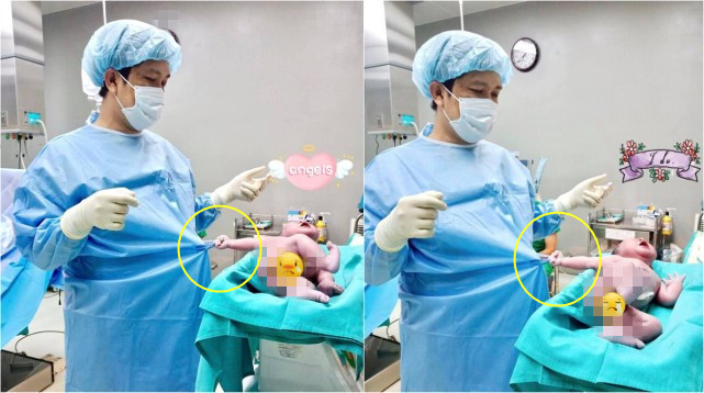 剛出生幾秒鐘的嬰兒拉住醫生手術服不撒手，照片發布後萌翻網友：瞧這暴脾氣