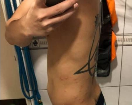 沒說有蟲！清潔人員「被上萬隻跳蚤咬」嚇到逃走　驚曝「一進到廚房超可怕」：1小時2千也不接