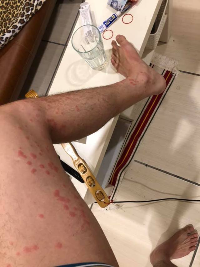 沒說有蟲！清潔人員「被上萬隻跳蚤咬」嚇到逃走　驚曝「一進到廚房超可怕」：1小時2千也不接