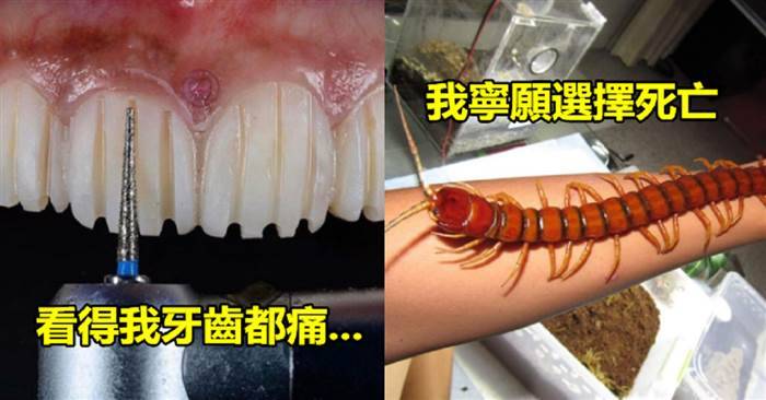 30張挑戰你忍耐力的超極致照片~~~ #1 好惡心這團是什麼東西啊？