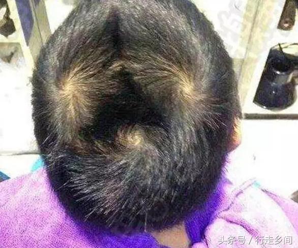 頭 上 幾 個 旋 的 人 命 好？真的准！