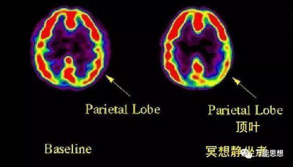 冥想真的可以改變大腦功能嗎？