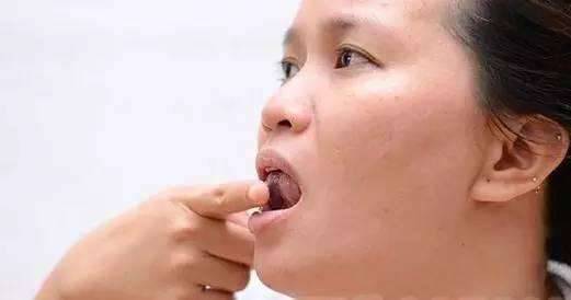 口臭自己聞不到？3個自檢小方法，1種茶，輕鬆去口臭！！