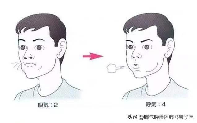 慢支、慢阻肺每日需做呼吸鍛煉，呼吸鍛煉方法有哪些有何好處？