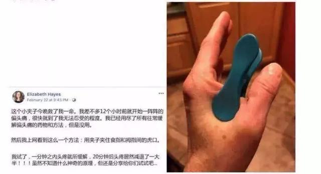 這個小夾子今晚救了我一命，一分鐘緩解頭痛？小偏方震驚外國網友