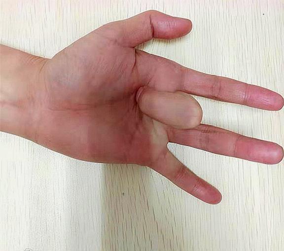 血壓升高，心絞痛，頭脹，心慌，打嗝，找准點按位置，1分鐘起效
