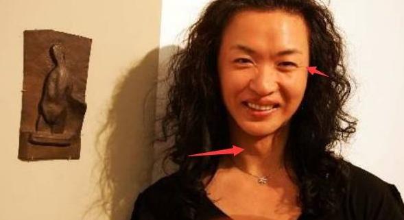 為保命放棄形象，不再服用激素藥物，金星51歲快要變成老爺爺！