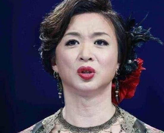 為保命放棄形象，不再服用激素藥物，金星51歲快要變成老爺爺！