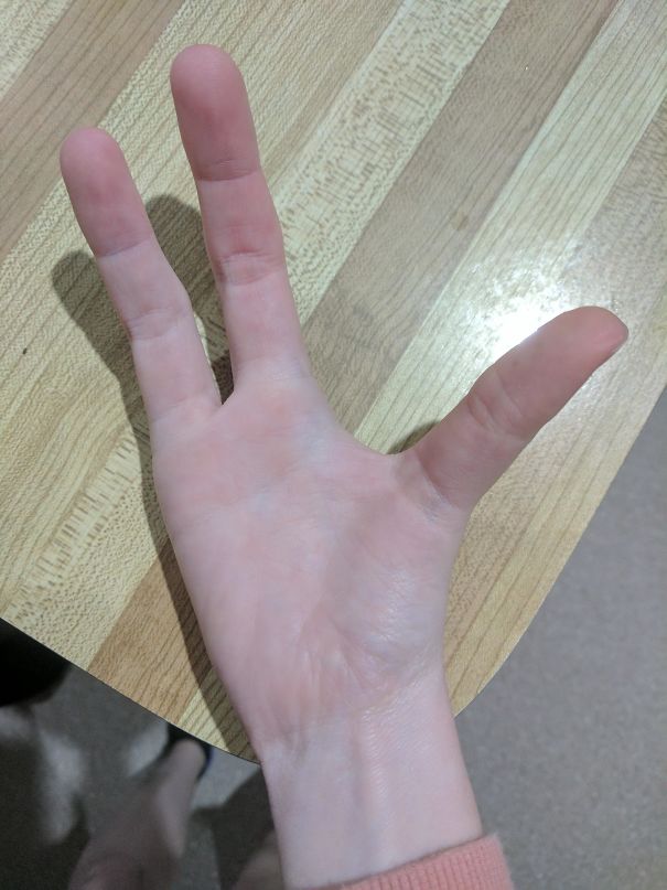 上帝的小小巧思　30個「出生就註定與眾不同」的超特別人類