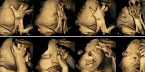 孕婦做彩色超音波，胎兒卻不停做鬼臉！她誇孩子是天才，醫生卻冷回：「打掉吧」！