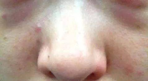 晚上睡不著，易失眠，口幹口苦，警惕肝火過旺，3個小方法降肝火，肝越來越好...