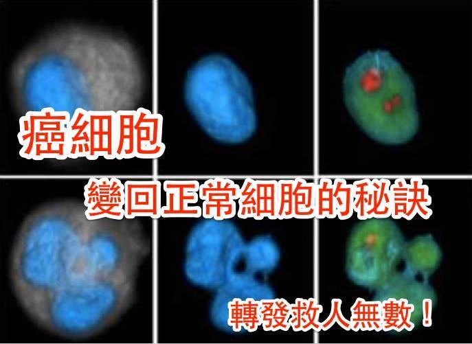 癌症不可怕！關鍵是如何把癌細胞變回正常細胞，秘訣就在這裡！！