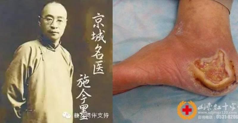 中國四大名醫的糖尿病驗方，沒有一個病患是救不回來的，不想吃藥一輩子的一定要看！