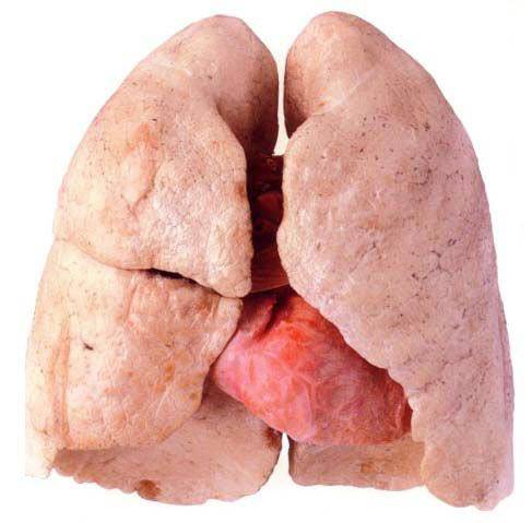 癌症其實有徵兆！留意身體有沒有「這些」情況，可以預防癌症纏身！