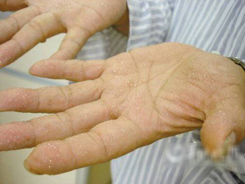癌症其實有徵兆！留意身體有沒有「這些」情況，可以預防癌症纏身！