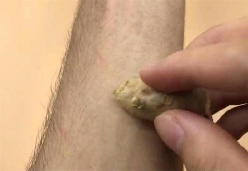 生薑抹在腳上太厲害了，可惜知道的人並不多，學會受用一輩子 