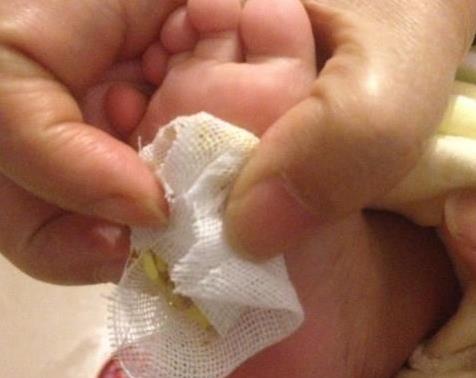 生薑抹在腳上太厲害了，可惜知道的人並不多，學會受用一輩子 