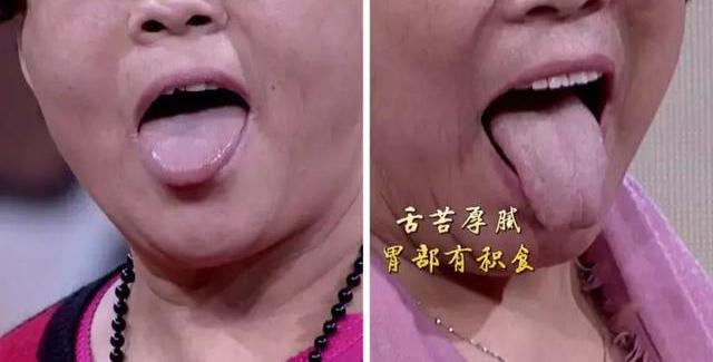 長壽老國醫，每天躺著動一動，無病無痛又長壽，還不花錢~