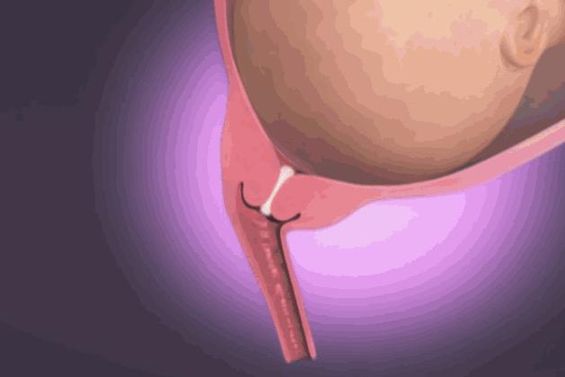 生孩子究竟有多痛？分娩體驗過後，誰還敢說「不就是生個孩子嘛」