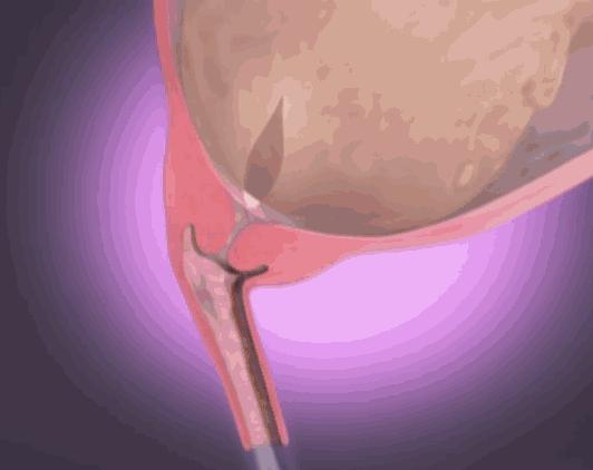 生孩子究竟有多痛？分娩體驗過後，誰還敢說「不就是生個孩子嘛」