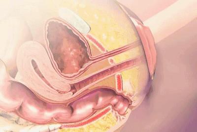生孩子究竟有多痛？分娩體驗過後，誰還敢說「不就是生個孩子嘛」